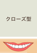 クローズ型